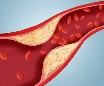 Anti-inflammatory Effects Anti-inflammatory Effects