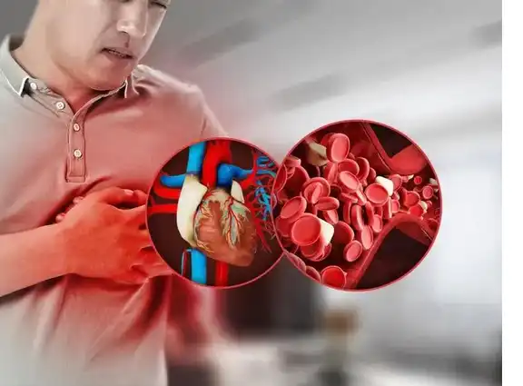 Cardiovascular Health Cardiovascular Health