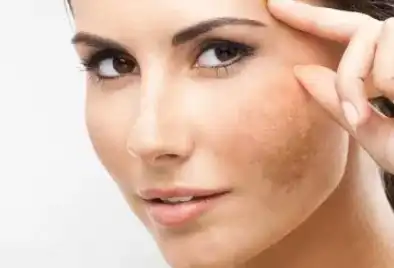 Eyebright Extract Beneficial Eyebright Extract Beneficial